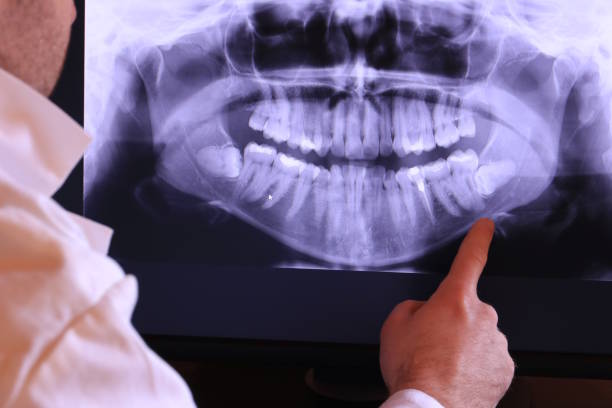 Best Emergency Treatment for Dental Infections or Abscesses in Davis, OK