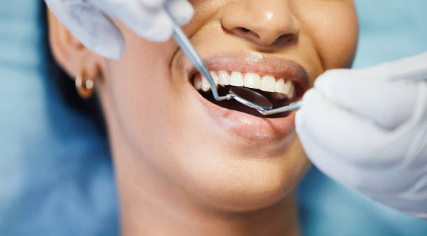 Best Same-Day Emergency Dental Services in Davis, OK