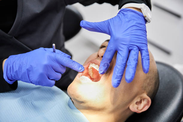 Best Emergency Dental Care for Broken or Chipped Teeth in Davis, OK