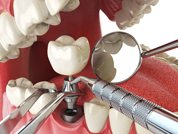 Emergency TMJ Treatment