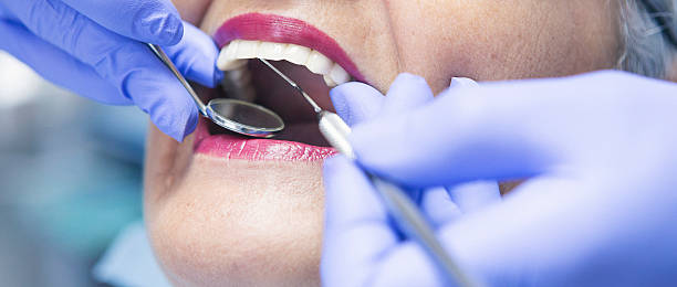 Best Emergency Tooth Extraction in Davis, OK